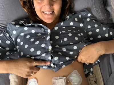 Excision Surgery Part 1: From The OR To My&nbsp;Bed